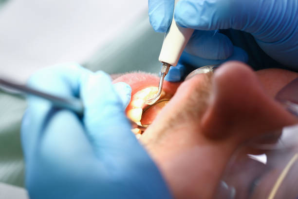 Best Pediatric Emergency Dentist in Upland, CA